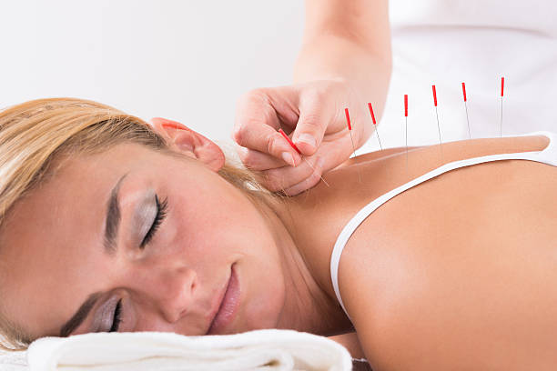 hand-performing-acupuncture-therapy-on-customers-back-picture-id586043646